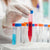 Thymol Blue Water Soluble | Spectrum Chemicals Australia